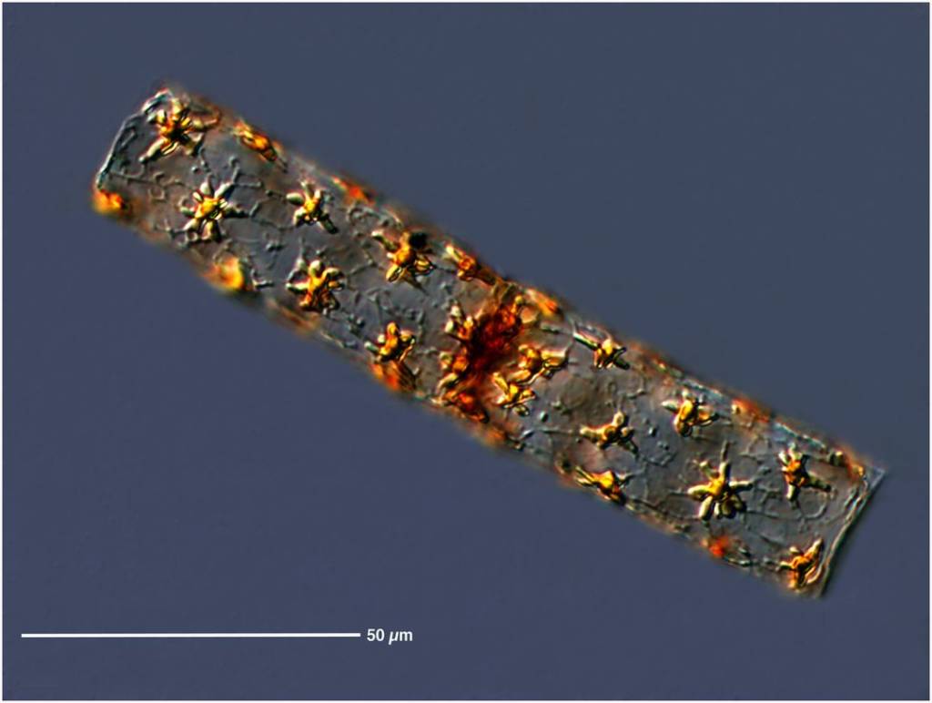 Les diatomées font partie du plancton végétal © Dr. John R. Dolan, Laboratoire d'Oceanographique de Villefranche-sur-Mer/NOAA Photo Library