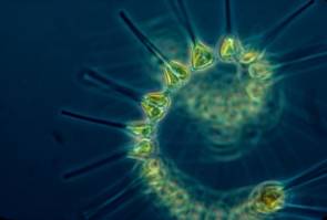 Phytoplancton © NOAA MESA Project