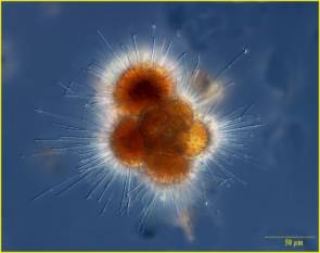 Ce globigérinidé fait partie de la famille des foraminifères. Il mesure généralement entre 100 micromètre à 1 mm. © NOAA