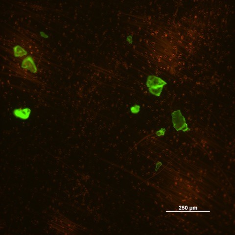 Microplastiques (inférieurs à 1 mm) détectés en mer grâce au colorant fluorescent et observés à l'aide d'un microscope © Université de Warwick